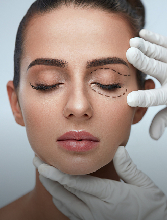 Blepharoplasty